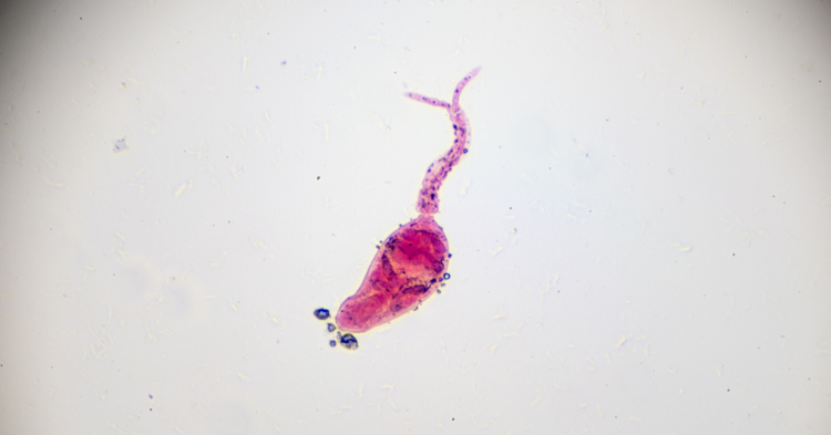 Roundworm-Schistosoma (Skin-Swimmer's Itch) 13