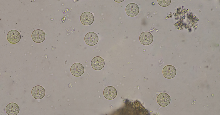 Protozoal Parasites 1