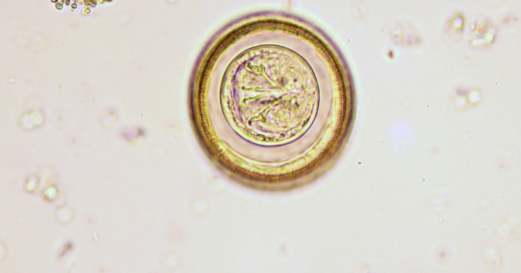 Tapeworm-Hymenolepis 1