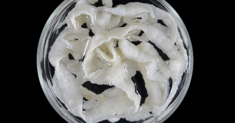 Tapeworm-Taenea saginata 5