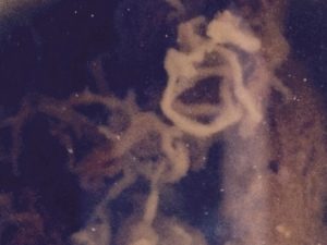 Close up of a tapeworm in the toilet. 