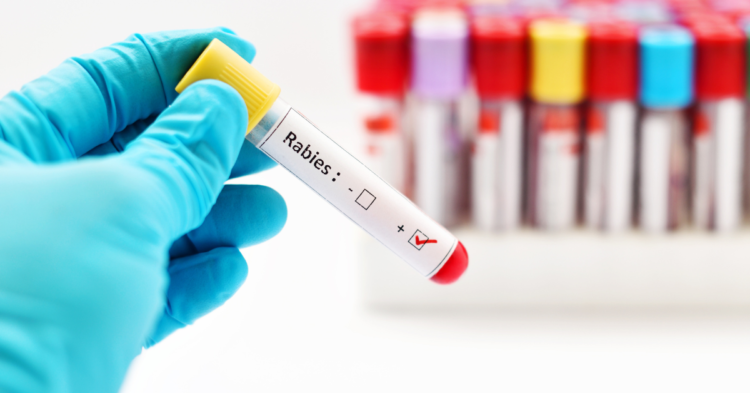 Rabies Antibody Screening Test 1