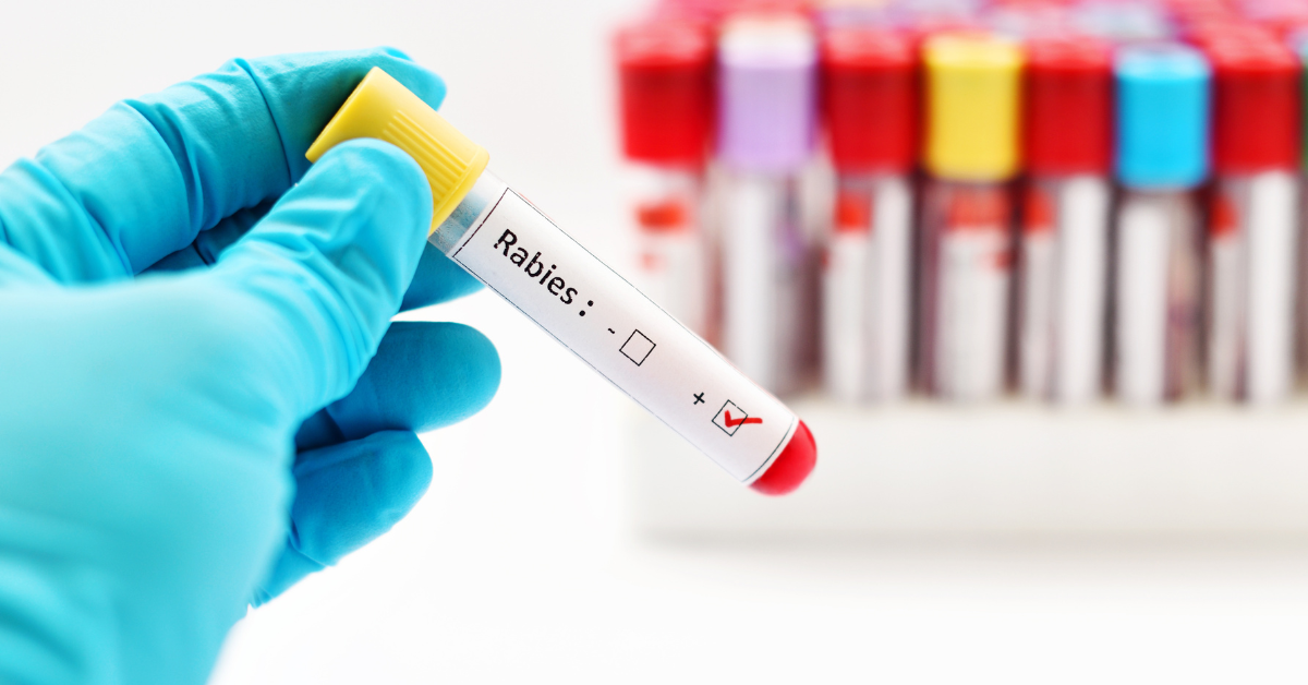 Rabies Antibody Screening Test - Natural Health Techniques